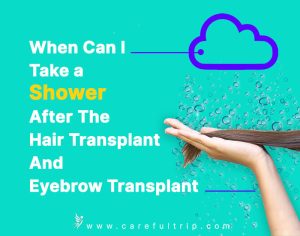 When Can I Take a Shower After The Hair Transplant And Eyebrow Transplant?