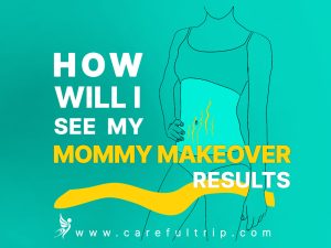 How Will I See My Mommy Makeover Results?