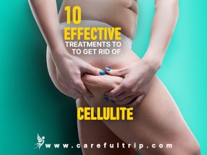 10  Effective Treatments to Get Rid Of Cellulite