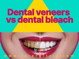 Dental Bleaching vs. Dental Veneers