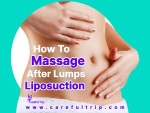 How To Massage Lumps After Liposuction?