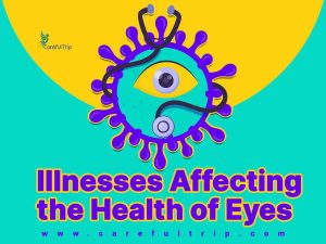 Illnesses affecting the health of the eyes