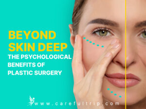 Beyond Skin Deep: The Psychological Benefits of Plastic Surgery