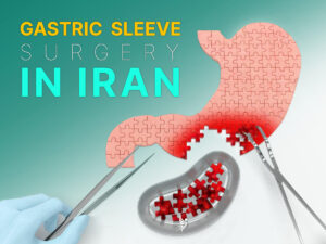 Gastric Sleeve Surgery in Iran