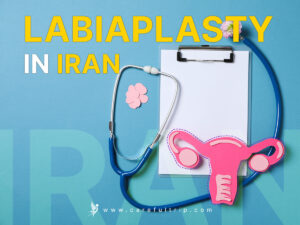 Labiaplasty in Iran