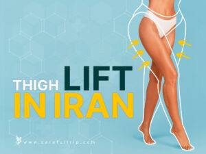 Thigh Lift in Iran