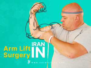 Arm Lift Surgery in Iran (Brachioplasty)