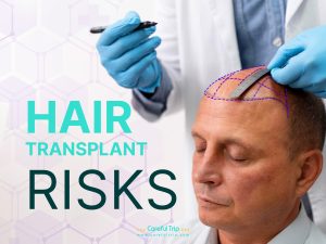 Hair Transplant Risk