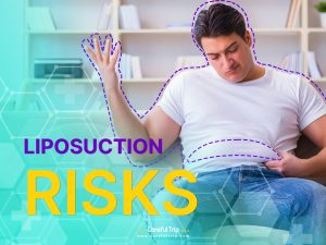 Liposuction Risks