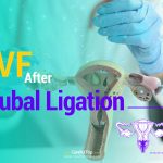 IVF After Tubal Ligation